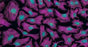 Cili është ndryshimi mes një tumori dhe kancerit?